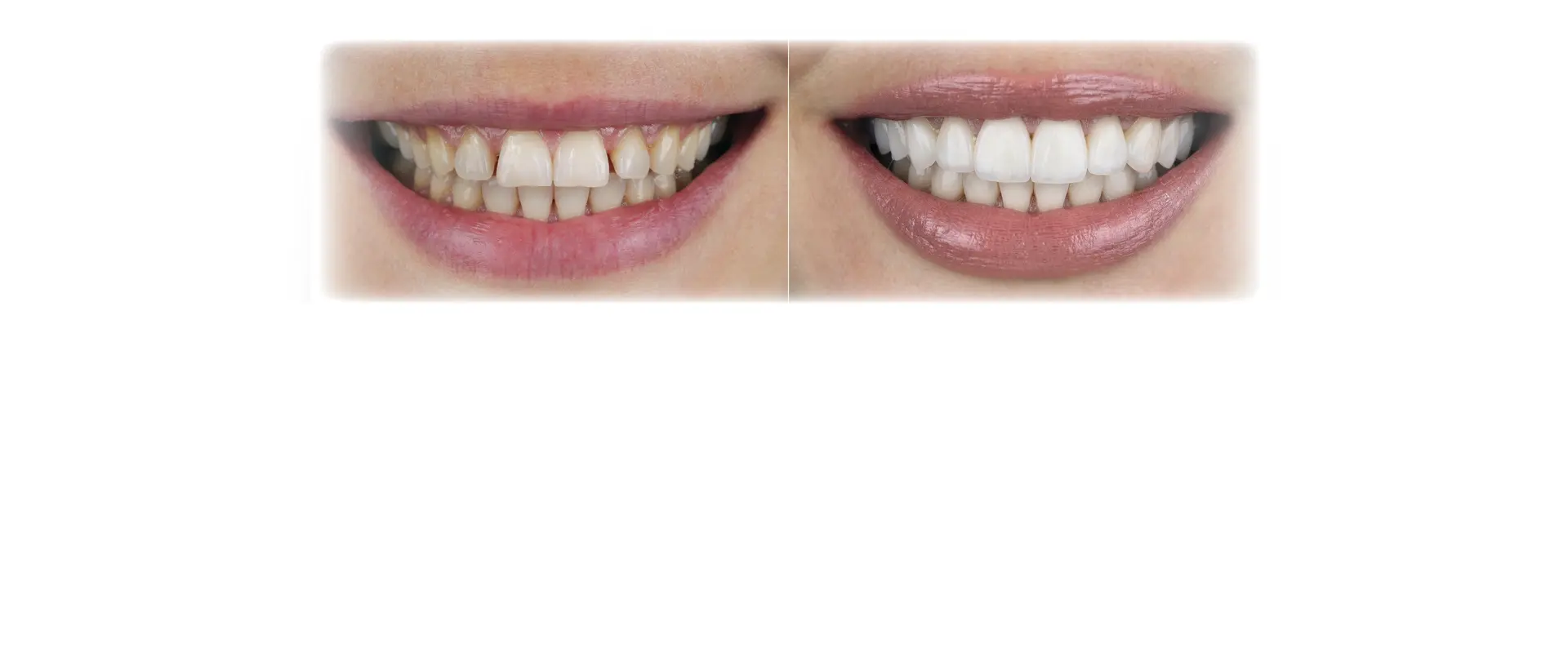 Complimentary Cosmetic Consultation